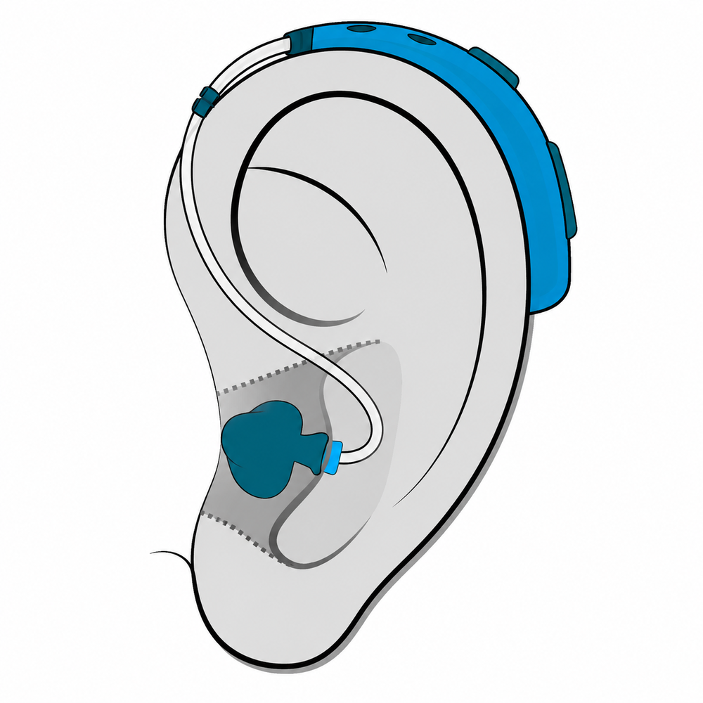 Behind-the-Ear (BTE) hearing aid style available at Physicians Hearing Clinic in Sarasota, FL