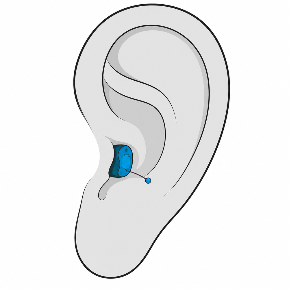 Completely-in-Canal (CIC) hearing aid style available at Physicians Hearing Clinic in Sarasota, FL