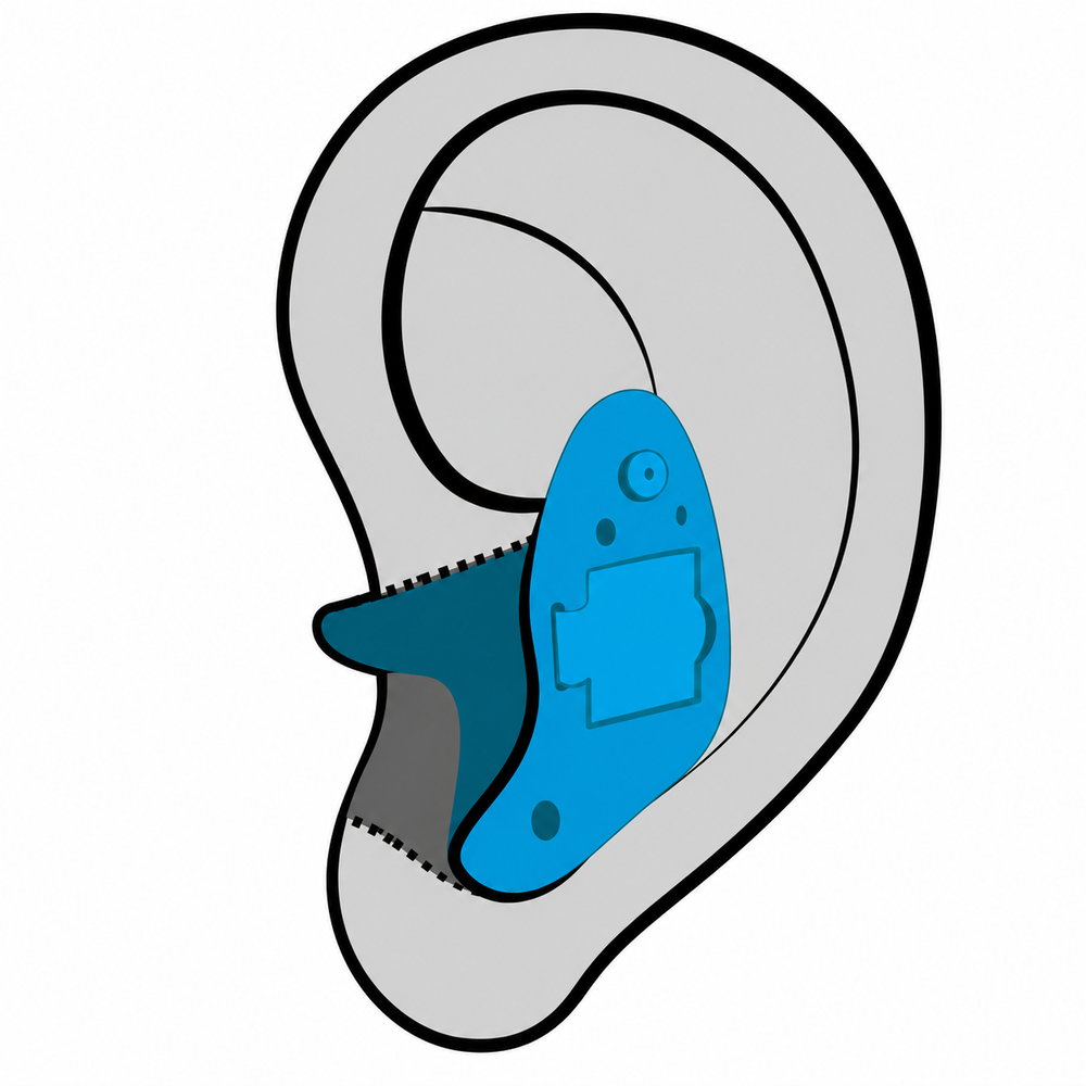 In-the-Ear (ITE) hearing aid style available at Physicians Hearing Clinic in Sarasota, FL