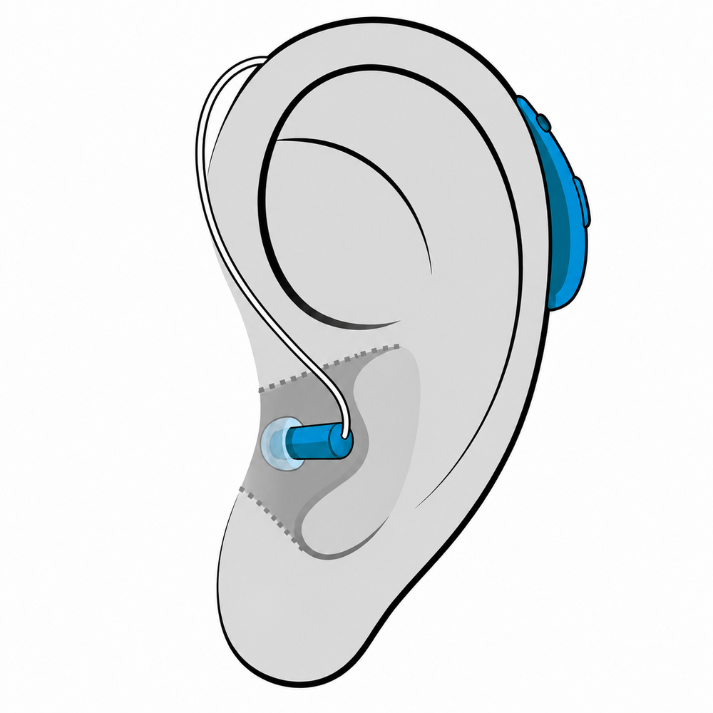 Receiver-in-Canal (RIC) hearing aid style available at Physicians Hearing Clinic in Sarasota, FL